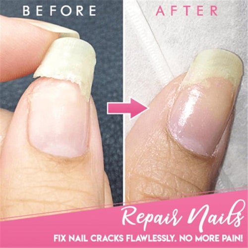 NAIL REPAIR GEL